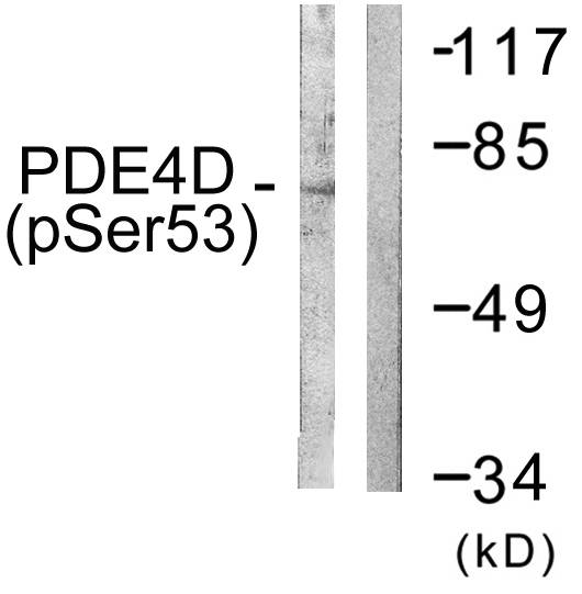PDE4D Antibody - Western blot analysis of lysates from K562 cells treated with H2O2 100uM 30', using PDE4D (Phospho-Ser190/53) Antibody. The lane on the right is blocked with the phospho peptide.