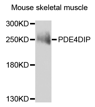 PDE4DIP / MMGL Antibody - Western blot analysis of extracts of mouse skeletal muscle.