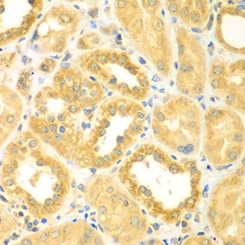 PDE4DIP / MMGL Antibody - Immunohistochemistry of paraffin-embedded human kidney tissue.