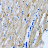 PDE4DIP / MMGL Antibody - Immunohistochemical analysis of Myomegalin staining in rat heart formalin fixed paraffin embedded tissue section. The section was pre-treated using heat mediated antigen retrieval with sodium citrate buffer (pH 6.0). The section was then incubated with the antibody at room temperature and detected using an HRP conjugated compact polymer system. DAB was used as the chromogen. The section was then counterstained with hematoxylin and mounted with DPX.