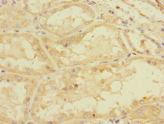 PDE4DIP / MMGL Antibody - Immunohistochemistry of paraffin-embedded human kidney tissue at dilution 1:100