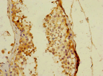 PDE4DIP / MMGL Antibody - Immunohistochemistry of paraffin-embedded human testis tissue at dilution 1:100