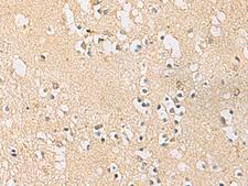 PDE4DIP / MMGL Antibody - Immunohistochemistry of paraffin-embedded Human brain tissue  using PDE4DIP Polyclonal Antibody at dilution of 1:45(×200)