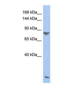 PDE6A / PDE6 Alpha Antibody - Western blot of Human Fetal Thymus. PDE6A antibody dilution 1.0 ug/ml.  This image was taken for the unconjugated form of this product. Other forms have not been tested.