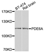 PDE6A / PDE6 Alpha Antibody - Western blot analysis of extracts of various cells.