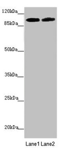 PDE6A / PDE6 Alpha Antibody - Western blot All Lanes: PDE6A antibody at 3.33 ug/ml Lane 1: Mouse eye tissue Lane 2: A549 whole cell lysate Secondary Goat polyclonal to rabbit IgG at 1/10000 dilution Predicted band size: 100 kDa Observed band size: 100 kDa