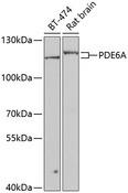 PDE6A / PDE6 Alpha Antibody - Western blot analysis of extracts of various cell lines using PDE6A Polyclonal Antibody at dilution of 1:1000.