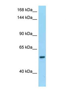 PDE6B / PDE6 Beta Antibody - PDE6B / PDE6 Beta antibody Western blot of Placenta lysate. Antibody concentration 1 ug/ml.  This image was taken for the unconjugated form of this product. Other forms have not been tested.