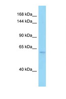 PDE6B / PDE6 Beta Antibody - PDE6B / PDE6 Beta antibody Western blot of 293T Cell lysate. Antibody concentration 1 ug/ml.  This image was taken for the unconjugated form of this product. Other forms have not been tested.