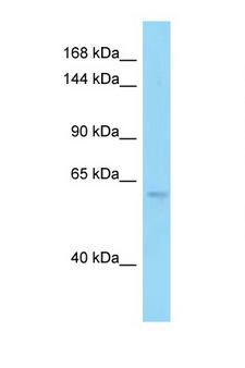 PDE6B / PDE6 Beta Antibody - PDE6B / PDE6 Beta antibody Western blot of 293T Cell lysate. Antibody concentration 1 ug/ml.  This image was taken for the unconjugated form of this product. Other forms have not been tested.