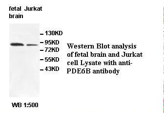 PDE6B / PDE6 Beta Antibody