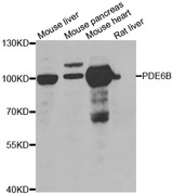 PDE6B / PDE6 Beta Antibody - Western blot analysis of extracts of various cell lines.