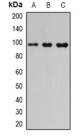 PDE6B / PDE6 Beta Antibody - Western blot analysis of PDE6-beta expression in mouse pancreas (A); mouse heart (B); rat liver (C) whole cell lysates.