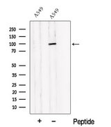 PDE6B / PDE6 Beta Antibody - Western blot analysis of extracts of A549 cells using PDE6B antibody. The lane on the left was treated with blocking peptide.