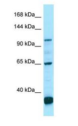 PDE6C Antibody - PDE6C antibody Western Blot of OVCAR-3.  This image was taken for the unconjugated form of this product. Other forms have not been tested.