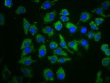 PDE6C Antibody - Immunofluorescence staining of A549 cells diluted at 1:66, counter-stained with DAPI. The cells were fixed in 4% formaldehyde, permeabilized using 0.2% Triton X-100 and blocked in 10% normal Goat Serum. The cells were then incubated with the antibody overnight at 4°C.The Secondary antibody was Alexa Fluor 488-congugated AffiniPure Goat Anti-Rabbit IgG (H+L).