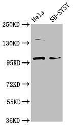 PDE6C Antibody - Western Blot Positive WB detected in: Hela whole cell lysate, SH-SY5Y whole cell lysate All Lanes: PDE6C antibody at 3.7µg/ml Secondary Goat polyclonal to rabbit IgG at 1/50000 dilution Predicted band size: 100 KDa Observed band size: 100 KDa