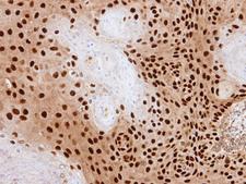 PDE6D / PDE6 Delta Antibody - IHC of paraffin-embedded SAS xenograft using PDE6D antibody at 1:500 dilution.