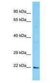 PDE6D / PDE6 Delta Antibody - PDE6D / PDE6 Delta antibody Western Blot of 293T. Antibody dilution: 1 ug/ml.  This image was taken for the unconjugated form of this product. Other forms have not been tested.