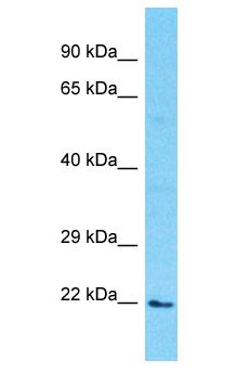 PDE6D / PDE6 Delta Antibody - PDE6D / PDE6 Delta antibody Western Blot of 293T. Antibody dilution: 1 ug/ml.  This image was taken for the unconjugated form of this product. Other forms have not been tested.
