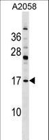 PDE6D / PDE6 Delta Antibody - PDE6D Antibody western blot of A2058 cell line lysates (35 ug/lane). The PDE6D antibody detected the PDE6D protein (arrow).