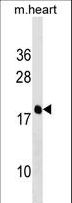PDE6D / PDE6 Delta Antibody - PDE6D Antibody western blot of mouse heart tissue lysates (35 ug/lane). The PDE6D antibody detected the PDE6D protein (arrow).