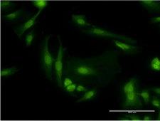 PDE6D / PDE6 Delta Antibody - Immunofluorescence of monoclonal antibody to PDE6D on HeLa cell . [antibody concentration 10 ug/ml]