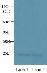 PDE6D / PDE6 Delta Antibody - Western blot. All lanes: PDE6D antibody at 1.5 ug/ml. Lane 1: A549 whole cell lysate. Lane 2: Mouse lung tissue. Secondary Goat polyclonal to Rabbit IgG at 1:10000 dilution. Predicted band size: 17 kDa. Observed band size: 17 kDa.