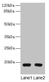 PDE6D / PDE6 Delta Antibody - Western blot All lanes: PDE6D antibody at 1.5µg/ml Lane 1: A549 whole cell lysate Lane 2: Mouse lung tissue Secondary Goat polyclonal to rabbit IgG at 1/10000 dilution Predicted band size: 17 kDa Observed band size: 17 kDa