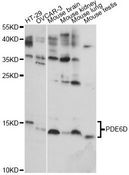 PDE6D / PDE6 Delta Antibody - Western blot analysis of extracts of various cell lines, using PDE6D antibody at 1:1000 dilution. The secondary antibody used was an HRP Goat Anti-Rabbit IgG (H+L) at 1:10000 dilution. Lysates were loaded 25ug per lane and 3% nonfat dry milk in TBST was used for blocking. An ECL Kit was used for detection and the exposure time was 10s.