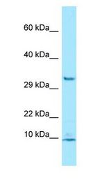 PDE6G / PDE6 Gamma Antibody - PDE6G / PDE6 Gamma antibody Western Blot of Jurkat.  This image was taken for the unconjugated form of this product. Other forms have not been tested.