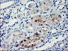 PDE6G / PDE6 Gamma Antibody - IHC of paraffin-embedded Human Kidney tissue using anti-PDE6G mouse monoclonal antibody.