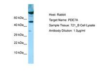 PDE7A Antibody -  This image was taken for the unconjugated form of this product. Other forms have not been tested.