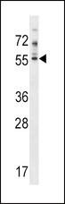 PDE7A Antibody - PDE7A Antibody western blot of NCI-H460 cell line lysates (35 ug/lane). The PDE7A antibody detected the PDE7A protein (arrow).