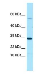 PDE7A Antibody - PDE7A antibody Western Blot of Placenta.  This image was taken for the unconjugated form of this product. Other forms have not been tested.
