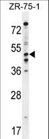 PDE7B Antibody - PDE7B Antibody western blot of ZR-75-1 cell line lysates (35 ug/lane). The PDE7B antibody detected the PDE7B protein (arrow).