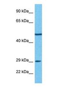 PDE7B Antibody - Western blot of PDE7B Antibody with human 786-0 Whole Cell lysate.  This image was taken for the unconjugated form of this product. Other forms have not been tested.