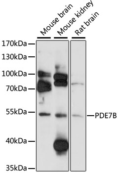 PDE7B Antibody - Western blot analysis of extracts of various cell lines, using PDE7B antibody at 1:1000 dilution. The secondary antibody used was an HRP Goat Anti-Rabbit IgG (H+L) at 1:10000 dilution. Lysates were loaded 25ug per lane and 3% nonfat dry milk in TBST was used for blocking. An ECL Kit was used for detection and the exposure time was 90s.