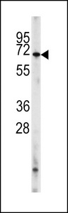 PDE8A Antibody - Western blot of PDE8A Antibody (L572) in HL60 cell line lysates (35 ug/lane). PDE8A (arrow) was detected using the purified antibody.