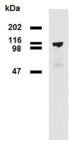 PDE8A Antibody - Western blotting analysis (reducing conditions) of PDE8a in HEK293T/17-PDE8a transfectants using mouse monoclonal antibody EM-52.