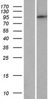 PDE8B Protein - Western validation with an anti-DDK antibody * L: Control HEK293 lysate R: Over-expression lysate