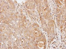 PDE9A Antibody - IHC of paraffin-embedded N87 xenograft using PDE9A antibody at 1:500 dilution.