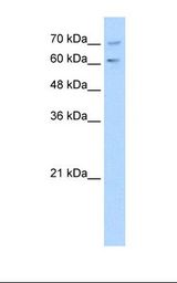 PDE9A Antibody - Jurkat cell lysate. Antibody concentration: 1.0 ug/ml. Gel concentration: 12%.  This image was taken for the unconjugated form of this product. Other forms have not been tested.