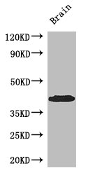 PDEF / SPDEF Antibody - Positive WB detected in:Mouse brain tissue;All lanes: SPDEF antibody at 3ug/ml;Secondary;Goat polyclonal to rabbit IgG at 1/50000 dilution;Predicted band size: 38,36 kDa;Observed band size: 38 kDa;