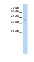 PDEF / SPDEF Antibody - SPDEF antibody ARP31841_T100-NP_036523-SPDEF(SAM pointed domain containing ets transcription factor) Antibody Western blot of MCF7 cell lysate.  This image was taken for the unconjugated form of this product. Other forms have not been tested.