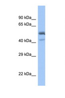 PDEF / SPDEF Antibody - SPDEF antibody Western blot of Fetal Muscle lysate. Antibody concentration 1 ug/ml. This image was taken for the unconjugated form of this product. Other forms have not been tested.