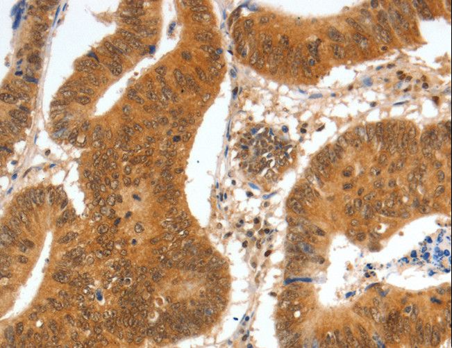 PDEF / SPDEF Antibody - Immunohistochemistry of paraffin-embedded Human tonsil using SPDEF Polyclonal Antibody at dilution of 1:60.