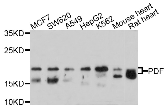 PDF / PLAB Antibody - Western blot analysis of extracts of various cell lines, using PDF antibody at 1:1000 dilution. The secondary antibody used was an HRP Goat Anti-Rabbit IgG (H+L) at 1:10000 dilution. Lysates were loaded 25ug per lane and 3% nonfat dry milk in TBST was used for blocking. An ECL Kit was used for detection and the exposure time was 30s.