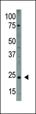 PDGF-AA Antibody - The anti-PDGFA is used in Western blot to detect PDGFA in HL60 cell lysate.