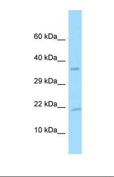 PDGF-AA Antibody - Western blot of Human U937. PDGFA antibody dilution 1.0 ug/ml.  This image was taken for the unconjugated form of this product. Other forms have not been tested.